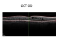 Thumbnail for version as of 11:55, June 17, 2012