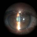 Thumbnail for version as of 16:15, May 8, 2023