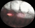 Thumbnail for version as of 11:55, October 19, 2015