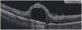 Thumbnail for version as of 19:31, May 23, 2023