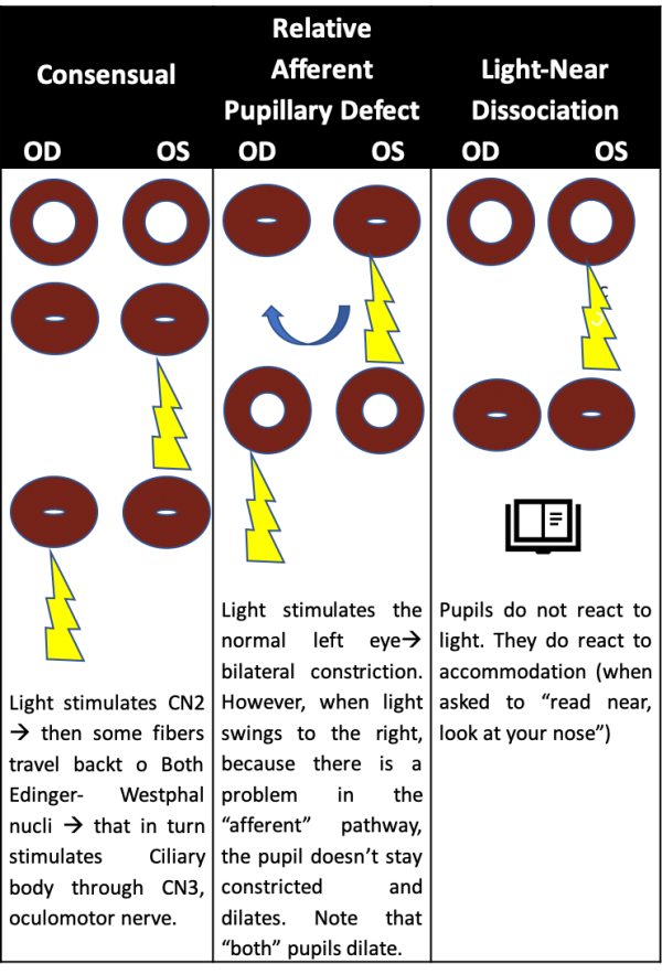 Reflexes and the Eye - EyeWiki