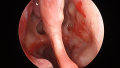 Thumbnail for version as of 18:15, April 27, 2018