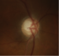 Thumbnail for version as of 11:07, April 4, 2014