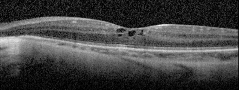 File:CME.PNG