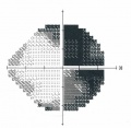 Thumbnail for version as of 10:52, April 29, 2012