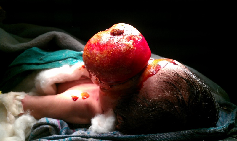 File:2Pre-op.jpg