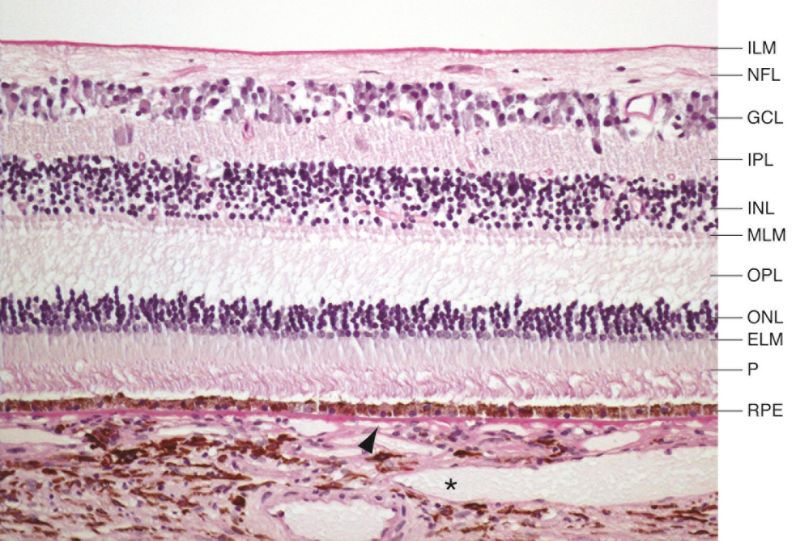 File:AA0 Retina Histology.jpg