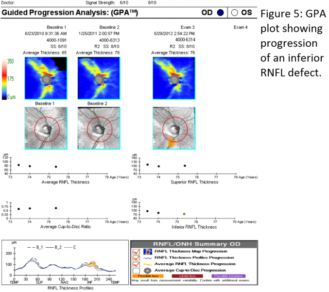 File:Figure 5 SD-OCT.png