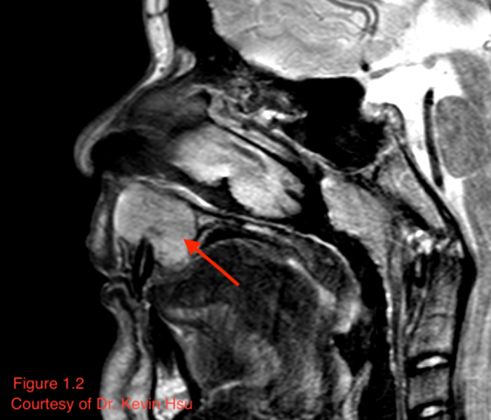 File:Image 1.2.png