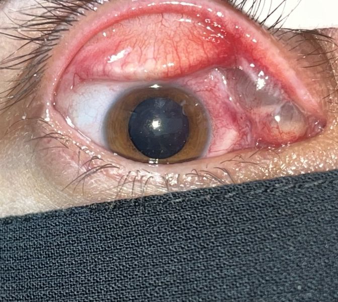 File:Infected WGDC.JPG