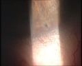 Thumbnail for version as of 06:59, June 2, 2019