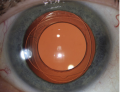 Thumbnail for version as of 08:29, June 1, 2021
