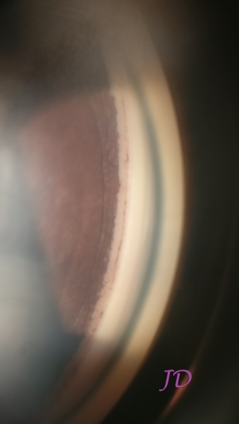 File:Smartphone-Angle-photo-Dr-John-Davis.jpg