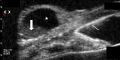 Thumbnail for version as of 11:41, May 24, 2021