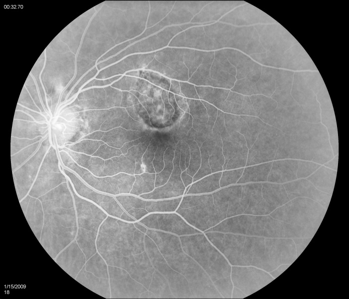 File:Figure 3B.jpg
