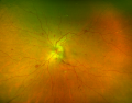 Thumbnail for version as of 09:04, April 16, 2022