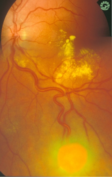 File:Composite 1.jpg