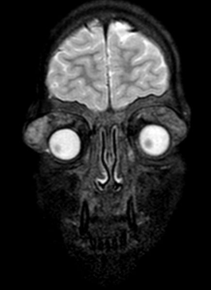 File:IgG4.jpg