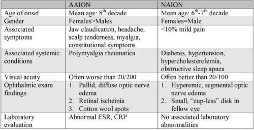 Important features that may help to differentiate arteritic ischemic optic neuropathy (AAION) from non-arteritic ischemic optic neuropathy (NAION).