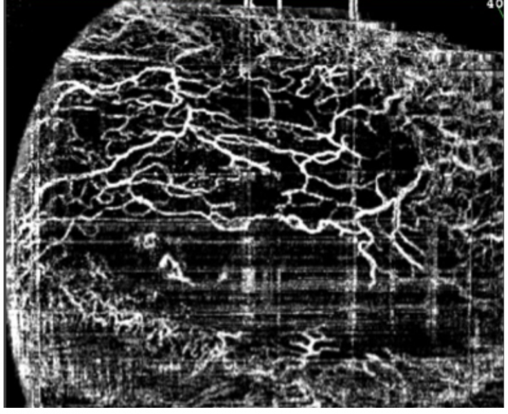 File:Fig 7.3 anamiguel octa bleb.png