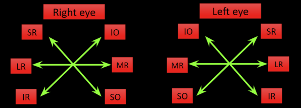 Sensory and Motor Testing - EyeWiki