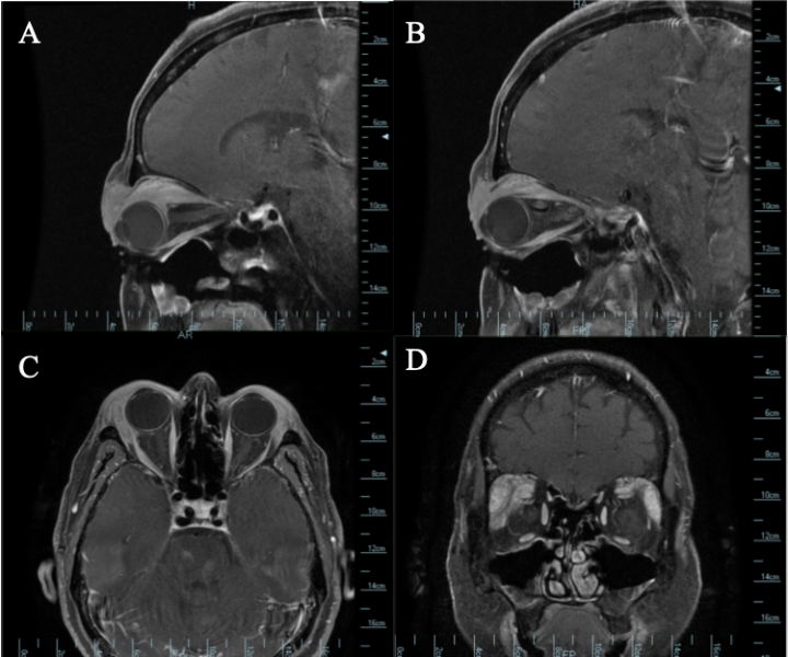 File:Image4.png