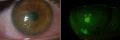Thumbnail for version as of 04:31, April 25, 2017