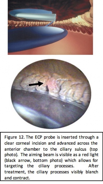 File:ECP figure 12.jpg