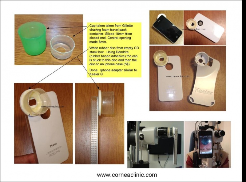 File:5iphoneslitlampadapter.jpg