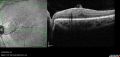 Thumbnail for version as of 09:17, October 15, 2026