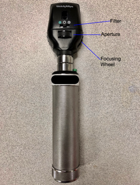 File:Figure1ophthalmoscopy.png