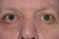 Thumbnail for version as of 11:32, November 30, 2011