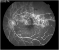 Thumbnail for version as of 10:49, June 14, 2010
