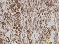 Thumbnail for version as of 06:18, May 14, 2011