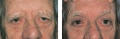 Thumbnail for version as of 11:01, July 7, 2010