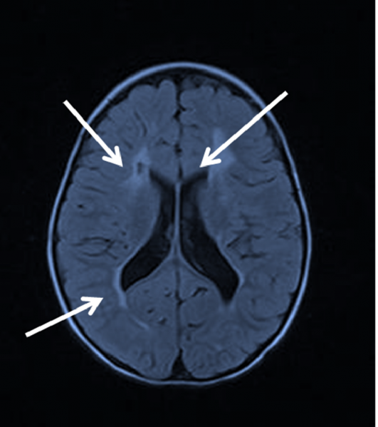 File:PVL.png