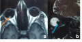 Thumbnail for version as of 05:46, June 1, 2021