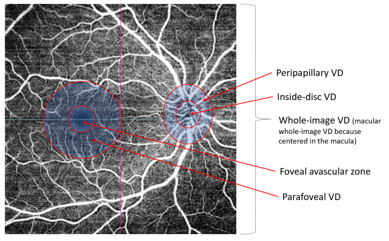 File:Fig 2 anamiguel octa terminology.png