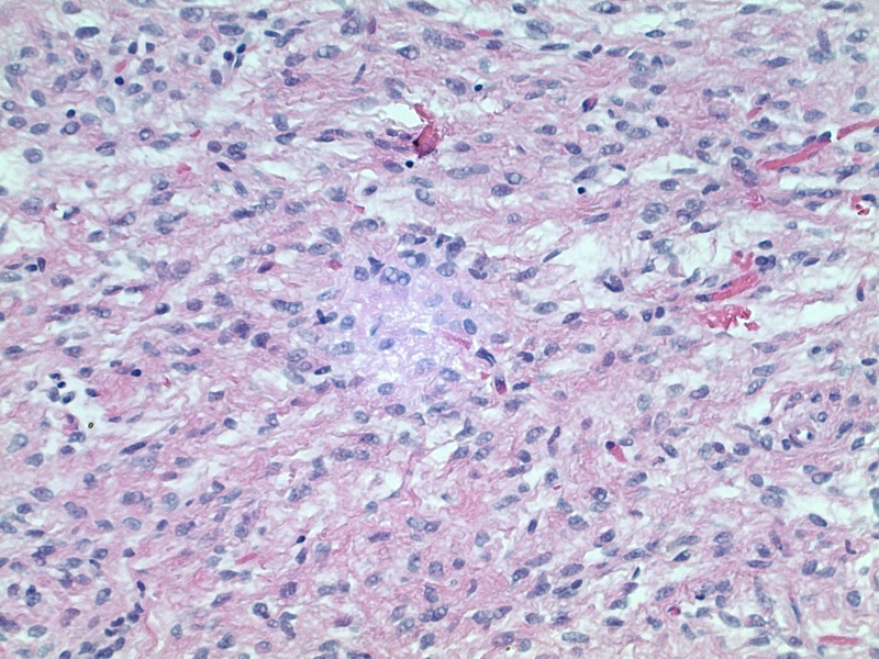 File:SFT 20x.jpg