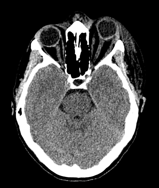File:AX CT.png