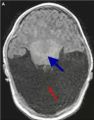Thumbnail for version as of 16:29, September 11, 2023