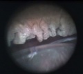 Thumbnail for version as of 11:55, December 3, 2011