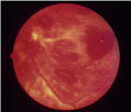 Thumbnail for version as of 10:40, September 29, 2013