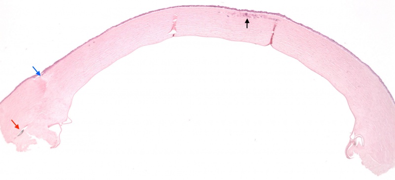 File:O13-501.CRYSTALLINE KERATOPATHY.10X.jpg