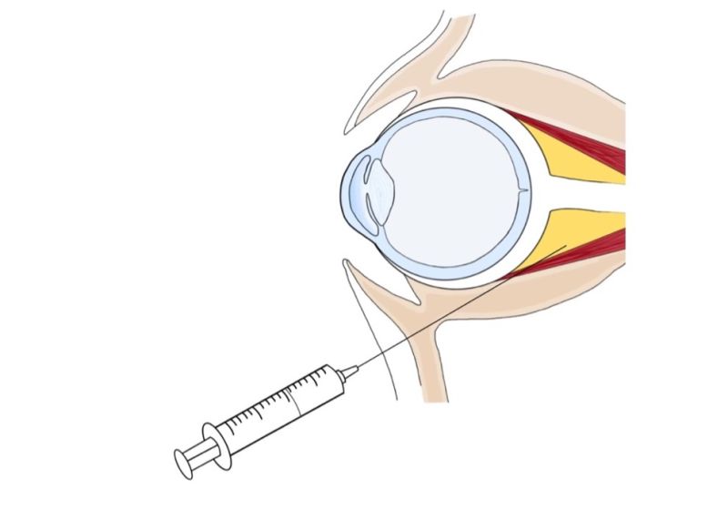 File:Figure 1 RBB.jpg