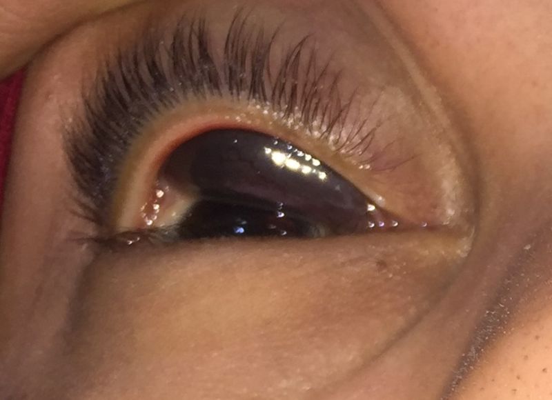 File:Bleeding in a WGDC.JPG