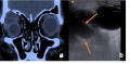 Thumbnail for version as of 04:48, June 1, 2021