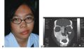 Thumbnail for version as of 15:24, May 8, 2023