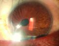 Thumbnail for version as of 19:03, August 10, 2026