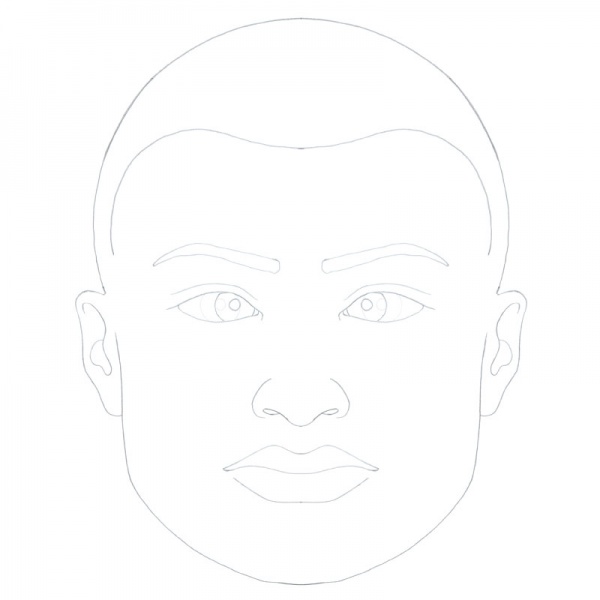 File:Esotropia.jpg